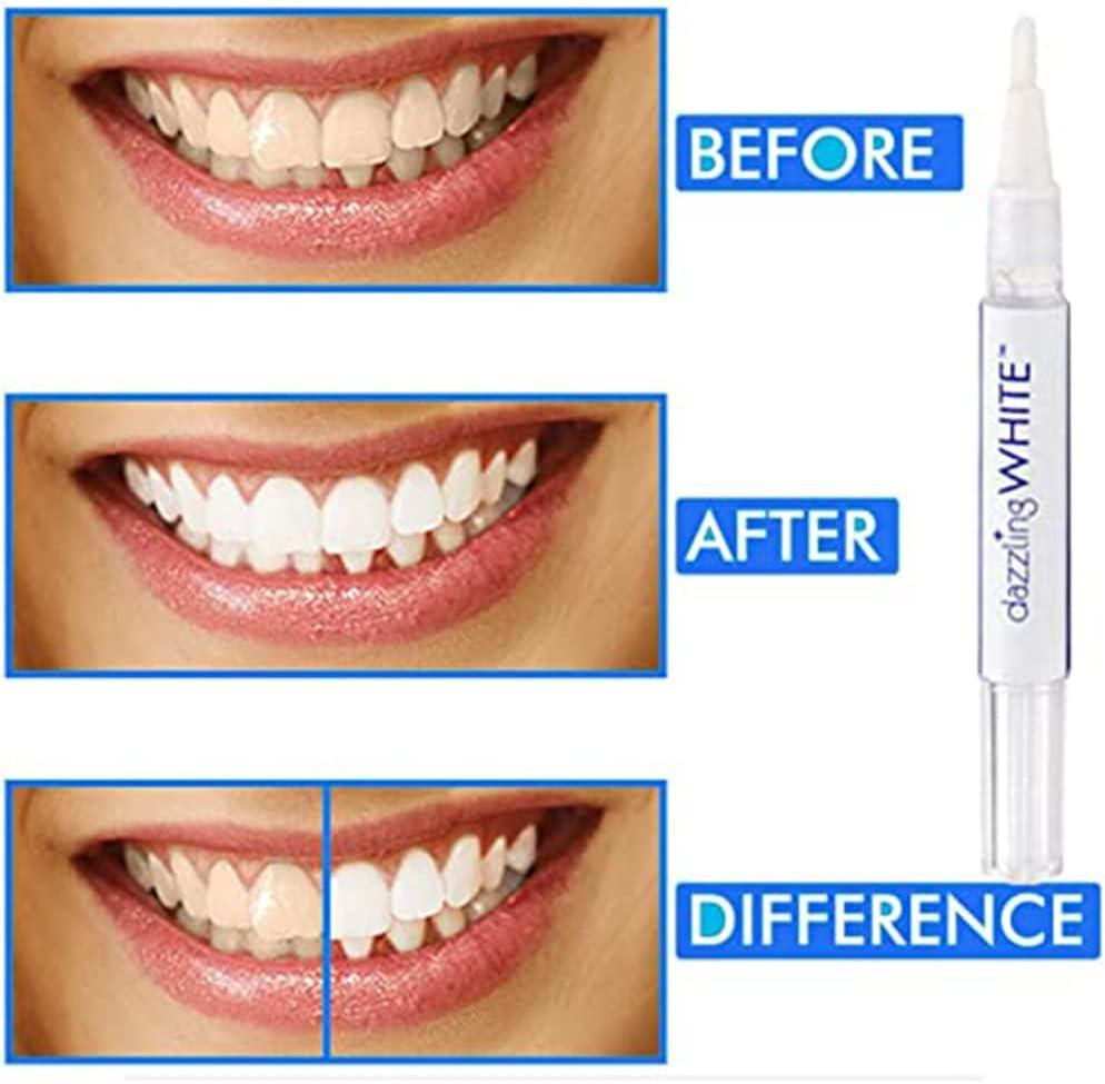 STYLO BLANCHISSEUR DE DENT