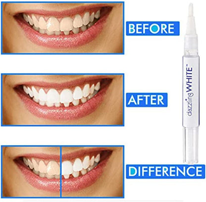 STYLO BLANCHISSEUR DE DENT